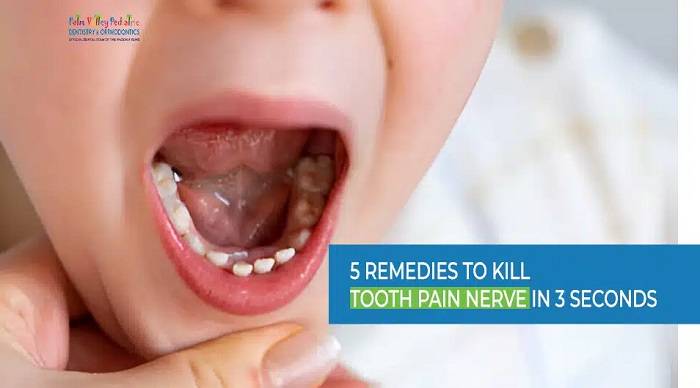 kill tooth pain nerve in 3 seconds permanentlygfdhh